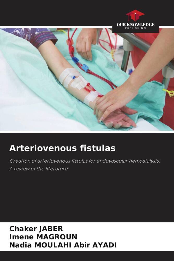 Arteriovenous fistulas