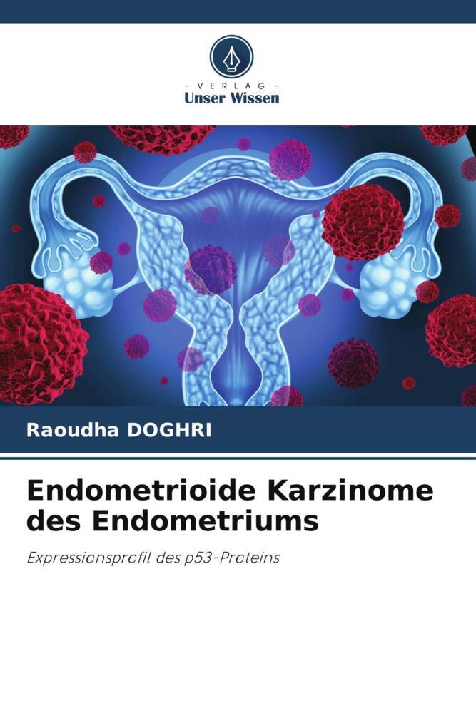Endometrioide Karzinome des Endometriums