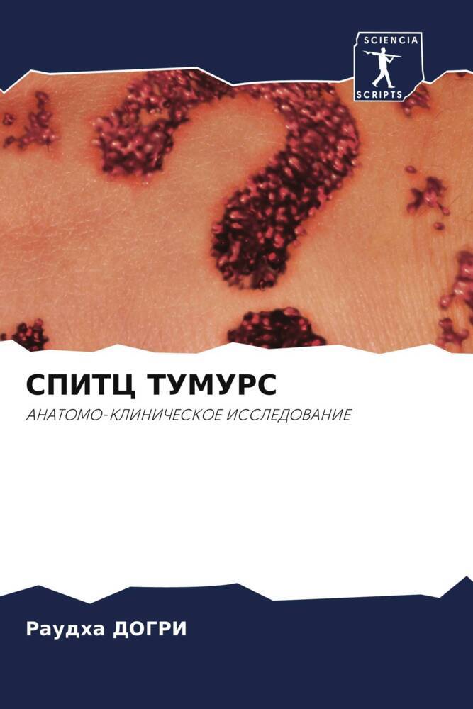 SPITC TUMURS