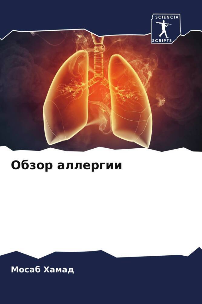 Obzor allergii