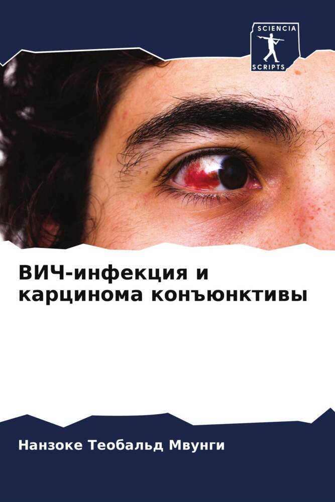 VICh-infekciq i karcinoma kon#ünktiwy
