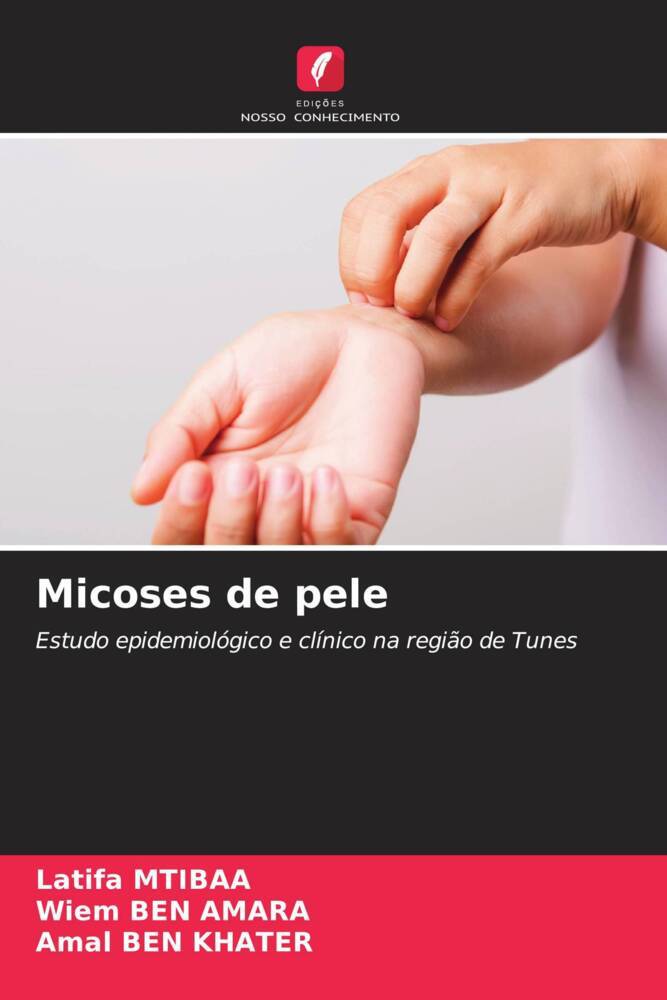 Micoses de pele