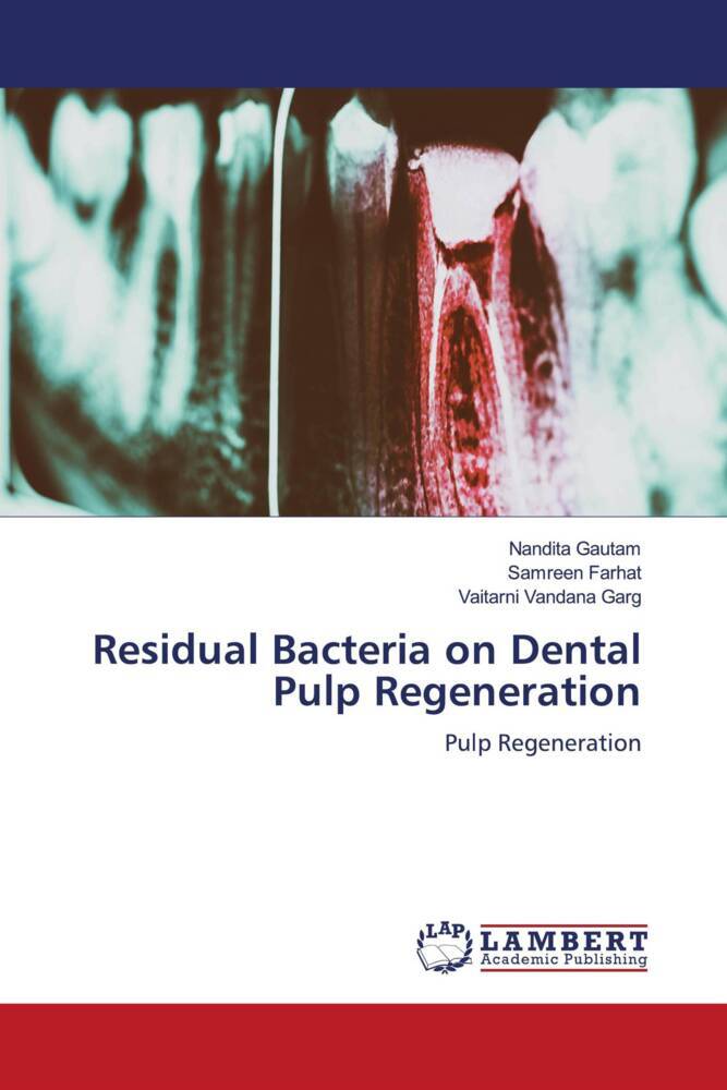 Residual Bacteria on Dental Pulp Regeneration