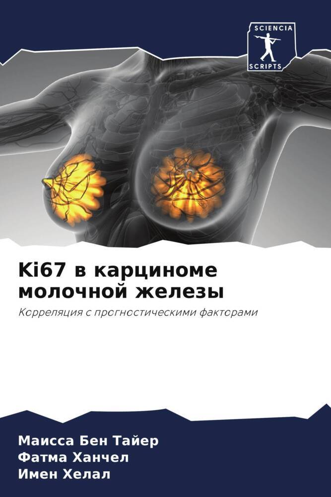 Ki67 w karcinome molochnoj zhelezy