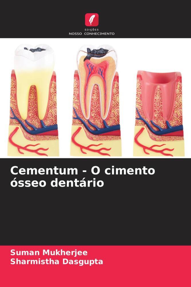 Cementum - O cimento ósseo dentário