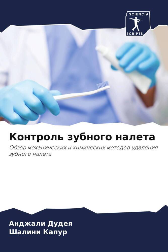 Kontrol' zubnogo naleta