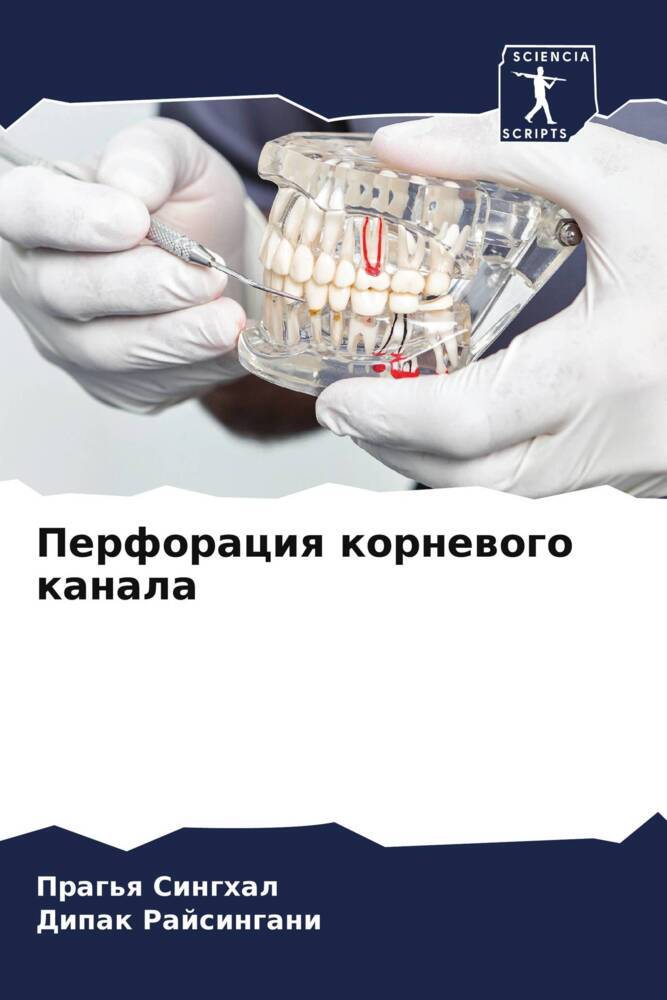 Perforaciq kornewogo kanala