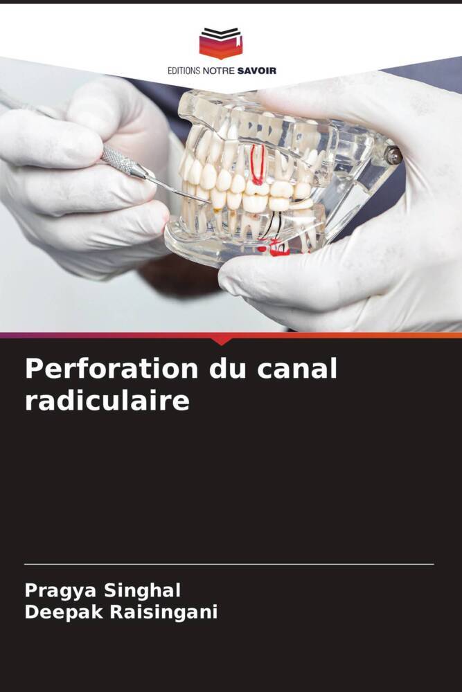 Perforation du canal radiculaire
