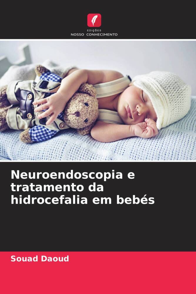 Neuroendoscopia e tratamento da hidrocefalia em bebés